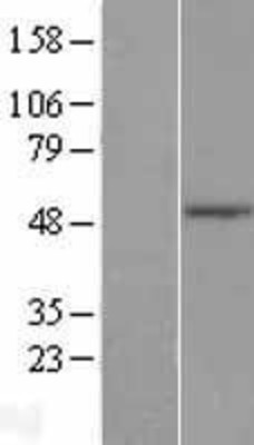 Western Blot: TLE6 Overexpression Lysate (Adult Normal) [NBL1-16946] Left-Empty vector transfected control cell lysate (HEK293 cell lysate); Right -Over-expression Lysate for TLE6.