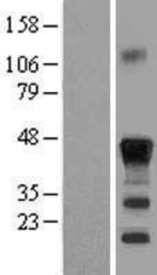 Western Blot: CEBP Beta Overexpression Lysate (Adult Normal) [NBL1-09074] Left-Empty vector transfected control cell lysate (HEK293 cell lysate); Right -Over-expression Lysate for CEBP Beta.