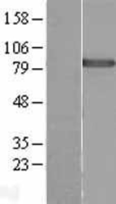 Western Blot: DDX50 Overexpression Lysate (Adult Normal) [NBL1-09802] Left-Empty vector transfected control cell lysate (HEK293 cell lysate); Right -Over-expression Lysate for DDX50.