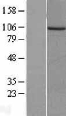Western Blot: PKN3 Overexpression Lysate (Adult Normal) [NBL1-14464] Left-Empty vector transfected control cell lysate (HEK293 cell lysate); Right -Over-expression Lysate for PKN3.