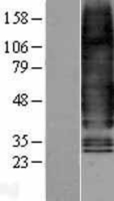Western Blot: Glucagon Receptor Overexpression Lysate (Adult Normal) [NBL1-11006] Left-Empty vector transfected control cell lysate (HEK293 cell lysate); Right -Over-expression Lysate for Glucagon Receptor.