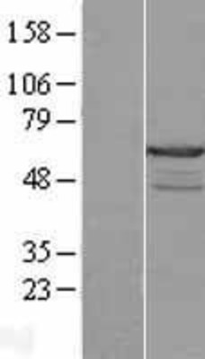 Western Blot: CABS1 Overexpression Lysate (Adult Normal) [NBL1-08476] Left-Empty vector transfected control cell lysate (HEK293 cell lysate); Right -Over-expression Lysate for CABS1.