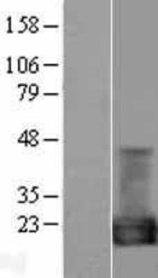 Western Blot: Cyclophilin A Overexpression Lysate (Adult Normal) [NBL1-14645] Left-Empty vector transfected control cell lysate (HEK293 cell lysate); Right -Over-expression Lysate for Cyclophilin A.