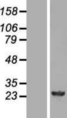 Western Blot: GSTM4 Overexpression Lysate (Adult Normal) [NBL1-11374] Left-Empty vector transfected control cell lysate (HEK293 cell lysate); Right -Over-expression Lysate for GSTM4.
