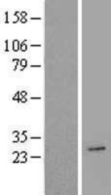 Western Blot: AICDA Overexpression Lysate (Adult Normal) [NBL1-07406] Left-Empty vector transfected control cell lysate (HEK293 cell lysate); Right -Over-expression Lysate for AICDA.