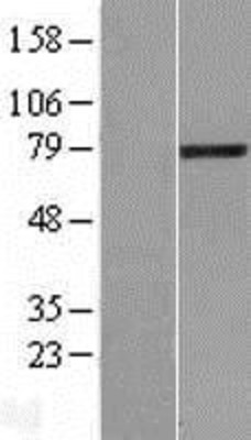 Western Blot: LCMT2 Overexpression Lysate (Adult Normal) [NBL1-12461] Left-Empty vector transfected control cell lysate (HEK293 cell lysate); Right -Over-expression Lysate for LCMT2.