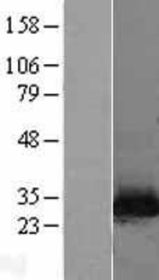 Western Blot: NNMT Overexpression Lysate (Adult Normal) [NBL1-13700] Left-Empty vector transfected control cell lysate (HEK293 cell lysate); Right -Over-expression Lysate for NNMT.