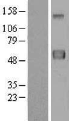 Western Blot: ERLEC1 Overexpression Lysate (Adult Normal) [NBL1-08410] Left-Empty vector transfected control cell lysate (HEK293 cell lysate); Right -Over-expression Lysate for ERLEC1.