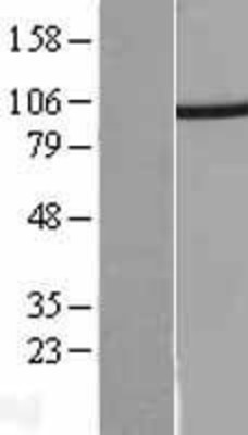 Western Blot: Proteasome 19S 10B Overexpression Lysate (Adult Normal) [NBL1-14900] Left-Empty vector transfected control cell lysate (HEK293 cell lysate); Right -Over-expression Lysate for Proteasome 19S 10B.