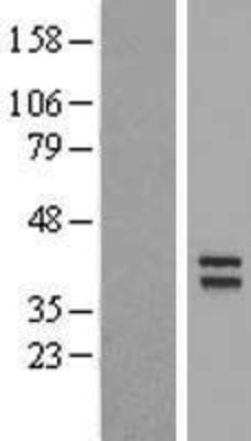 Western Blot: SLC25A25 Overexpression Lysate (Adult Normal) [NBP2-08830] Left-Empty vector transfected control cell lysate (HEK293 cell lysate); Right -Over-expression Lysate for SLC25A25.
