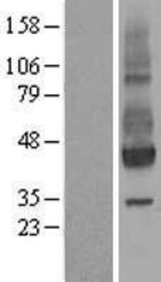 Western Blot: NPTN Overexpression Lysate (Adult Normal) [NBL1-13758] Left-Empty vector transfected control cell lysate (HEK293 cell lysate); Right -Over-expression Lysate for NPTN.