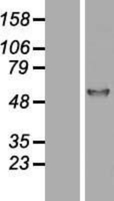 Western Blot: alpha 1 Antitrypsin Overexpression Lysate (Adult Normal) [NBL1-15834] Left-Empty vector transfected control cell lysate (HEK293 cell lysate); Right -Over-expression Lysate for alpha 1 Antitrypsin.
