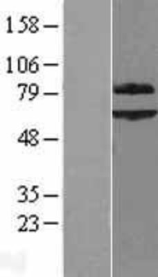 Western Blot: SUR-8 Overexpression Lysate (Adult Normal) [NBL1-15949] Left-Empty vector transfected control cell lysate (HEK293 cell lysate); Right -Over-expression Lysate for SUR-8.