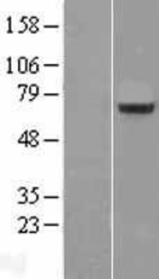 Western Blot: Splicing factor, arginine/serine-rich 11 Overexpression Lysate (Adult Normal) [NBL1-15888] Left-Empty vector transfected control cell lysate (HEK293 cell lysate); Right -Over-expression Lysate for Splicing factor, arginine/serine-rich 11.