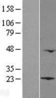Western Blot: LZIC Overexpression Lysate (Adult Normal) [NBL1-12775] Left-Empty vector transfected control cell lysate (HEK293 cell lysate); Right -Over-expression Lysate for LZIC.