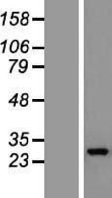 Western Blot: GOSR1 Overexpression Lysate (Adult Normal) [NBL1-11204] Left-Empty vector transfected control cell lysate (HEK293 cell lysate); Right -Over-expression Lysate for GOSR1.