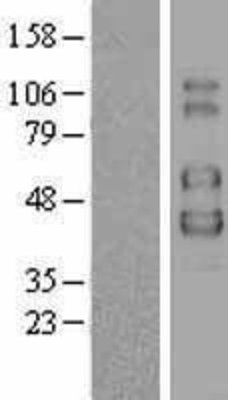 Western Blot: IL2 Receptor gamma Overexpression Lysate (Adult Normal) [NBL1-11949] Left-Empty vector transfected control cell lysate (HEK293 cell lysate); Right -Over-expression Lysate for IL2 Receptor gamma.