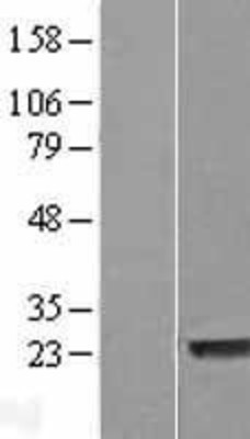 Western Blot: LYSMD1 Overexpression Lysate (Adult Normal) [NBL1-12768] Left-Empty vector transfected control cell lysate (HEK293 cell lysate); Right -Over-expression Lysate for LYSMD1.