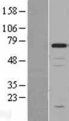 Western Blot: Chromogranin A Overexpression Lysate (Adult Normal) [NBL1-09149] Left-Empty vector transfected control cell lysate (HEK293 cell lysate); Right -Over-expression Lysate for Chromogranin A.