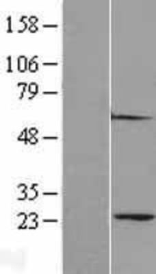 Western Blot: Proteasome 20S alpha 2 Overexpression Lysate (Adult Normal) [NBL1-14872] Left-Empty vector transfected control cell lysate (HEK293 cell lysate); Right -Over-expression Lysate for Proteasome 20S alpha 2.