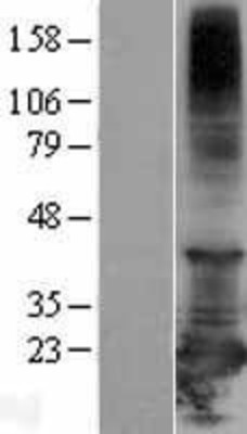 Western Blot: RBBP9 Overexpression Lysate (Adult Normal) [NBL1-15186] Left-Empty vector transfected control cell lysate (HEK293 cell lysate); Right -Over-expression Lysate for RBBP9.
