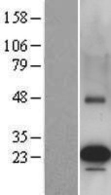 Western Blot: PEMT Overexpression Lysate (Adult Normal) [NBL1-14286] Left-Empty vector transfected control cell lysate (HEK293 cell lysate); Right -Over-expression Lysate for PEMT.