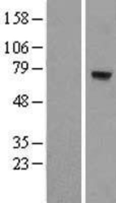 Western Blot: MTO1 Overexpression Lysate (Adult Normal) [NBL1-13381] Left-Empty vector transfected control cell lysate (HEK293 cell lysate); Right -Over-expression Lysate for MTO1.