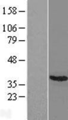 Western Blot: Craniofacial Development Protein 1 Overexpression Lysate (Adult Normal) [NBL1-09120] Left-Empty vector transfected control cell lysate (HEK293 cell lysate); Right -Over-expression Lysate for Craniofacial Development Protein 1.