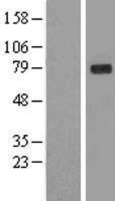 Western Blot: GLB1 Overexpression Lysate (Adult Normal) [NBL1-11105] Left-Empty vector transfected control cell lysate (HEK293 cell lysate); Right -Over-expression Lysate for GLB1.
