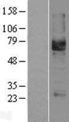 Western Blot: Podocalyxin Overexpression Lysate (Adult Normal) [NBL1-14562] Left-Empty vector transfected control cell lysate (HEK293 cell lysate); Right -Over-expression Lysate for Podocalyxin.