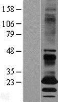 Western Blot: EBPL Overexpression Lysate (Adult Normal) [NBL1-10095] Left-Empty vector transfected control cell lysate (HEK293 cell lysate); Right -Over-expression Lysate for EBPL.