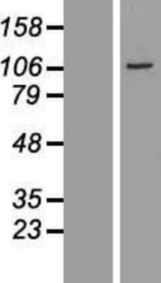 Western Blot: BEND2 Overexpression Lysate (Adult Normal) [NBL1-09637] Left-Empty vector transfected control cell lysate (HEK293 cell lysate); Right -Over-expression Lysate for BEND2.