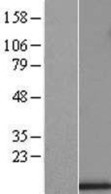 Western Blot: UQCRB Overexpression Lysate (Adult Normal) [NBL1-17628] Left-Empty vector transfected control cell lysate (HEK293 cell lysate); Right -Over-expression Lysate for UQCRB.