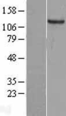 Western Blot: GUCY2C Overexpression Lysate (Adult Normal) [NBL1-11409] Left-Empty vector transfected control cell lysate (HEK293 cell lysate); Right -Over-expression Lysate for GUCY2C.
