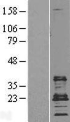 Western Blot: CD9 Overexpression Lysate (Adult Normal) [NBL1-08982] Left-Empty vector transfected control cell lysate (HEK293 cell lysate); Right -Over-expression Lysate for CD9.