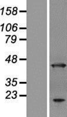 Western Blot: ANKRD2 Overexpression Lysate (Adult Normal) [NBL1-07535] Left-Empty vector transfected control cell lysate (HEK293 cell lysate); Right -Over-expression Lysate for ANKRD2.