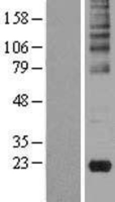 Western Blot: Gastrokine 2 Overexpression Lysate (Adult Normal) [NBL1-11103] Left-Empty vector transfected control cell lysate (HEK293 cell lysate); Right -Over-expression Lysate for Gastrokine 2.