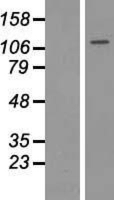 Western Blot: HDAC9 Overexpression Lysate (Adult Normal) [NBL1-11486] Left-Empty vector transfected control cell lysate (HEK293 cell lysate); Right -Over-expression Lysate for HDAC9.