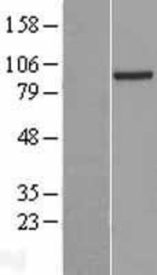 Western Blot: PRDM4 Overexpression Lysate (Adult Normal) [NBL1-14736] Left-Empty vector transfected control cell lysate (HEK293 cell lysate); Right -Over-expression Lysate for PRDM4.