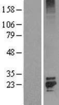 Western Blot: FGF7 Overexpression Lysate (Adult Normal) [NBL1-10700] Left-Empty vector transfected control cell lysate (HEK293 cell lysate); Right -Over-expression Lysate for FGF7.