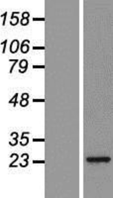 Western Blot: Proteasome 20S beta2 Overexpression Lysate (Adult Normal) [NBL1-14877] Left-Empty vector transfected control cell lysate (HEK293 cell lysate); Right -Over-expression Lysate for Proteasome 20S beta2.