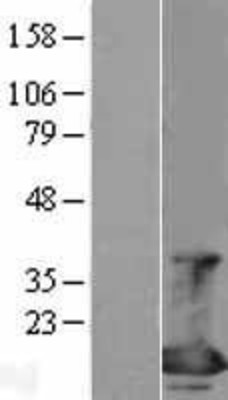 Western Blot: eIF4EBP1 Overexpression Lysate (Adult Normal) [NBL1-10206] Left-Empty vector transfected control cell lysate (HEK293 cell lysate); Right -Over-expression Lysate for eIF4EBP1.
