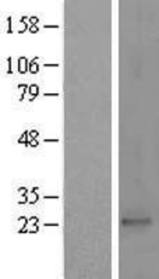 Western Blot: PRKRIP1 Overexpression Lysate (Adult Normal) [NBL1-14785] Left-Empty vector transfected control cell lysate (HEK293 cell lysate); Right -Over-expression Lysate for PRKRIP1.