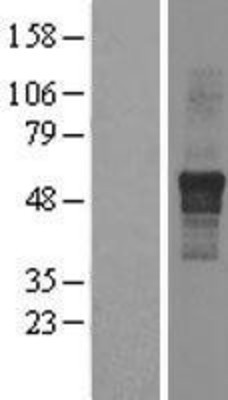 Western Blot: IPPK Overexpression Lysate (Adult Normal) [NBL1-12018] Left-Empty vector transfected control cell lysate (HEK293 cell lysate); Right -Over-expression Lysate for IPPK.