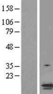 Western Blot: ASC/TMS1 Overexpression Lysate (Adult Normal) [NBL1-15017] Left-Empty vector transfected control cell lysate (HEK293 cell lysate); Right -Over-expression Lysate for ASC/TMS1.