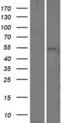 Western Blot: Presenilin 1 Overexpression Lysate (Adult Normal) [NBL1-14860] Left-Empty vector transfected control cell lysate (HEK293 cell lysate); Right -Over-expression Lysate for Presenilin 1.