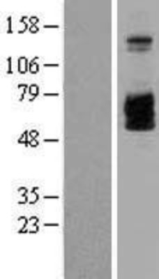 Western Blot: IL2 Receptor beta Overexpression Lysate (Adult Normal) [NBL1-11948] Left-Empty vector transfected control cell lysate (HEK293 cell lysate); Right -Over-expression Lysate for IL2 Receptor beta.