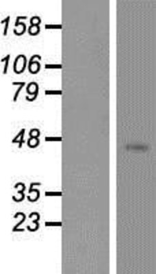 Western Blot: Neurokinin B Receptor Overexpression Lysate (Adult Normal) [NBP2-10908] Left-Empty vector transfected control cell lysate (HEK293 cell lysate); Right -Over-expression Lysate for Neurokinin B Receptor.