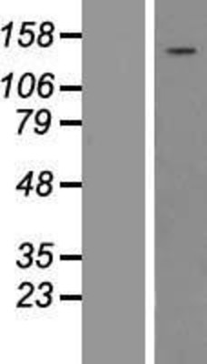 Western Blot: Phospholipase C gamma 1 Overexpression Lysate (Adult Normal) [NBP2-10838] Left-Empty vector transfected control cell lysate (HEK293 cell lysate); Right -Over-expression Lysate for Phospholipase C gamma 1.