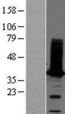 Western Blot: tropomyosin-2 Overexpression Lysate (Adult Normal) [NBP2-10870] Left-Empty vector transfected control cell lysate (HEK293 cell lysate); Right -Over-expression Lysate for tropomyosin-2.